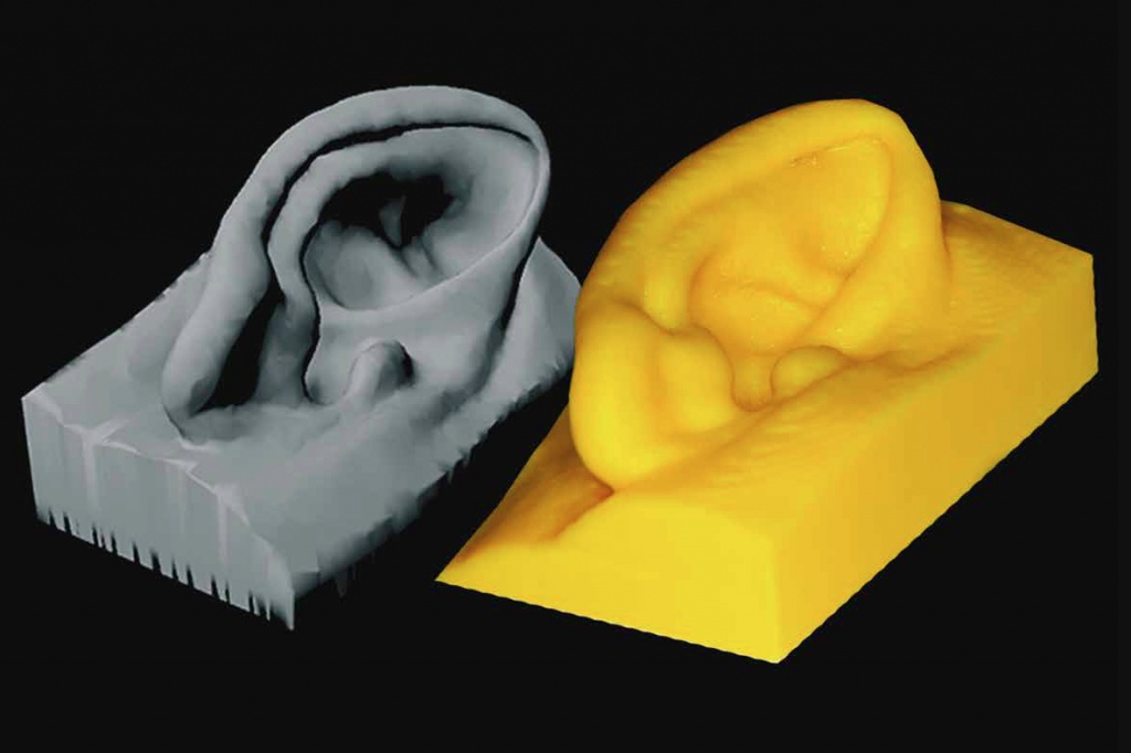 Сейчас имплант моделируют на компьютере и печают на 3D-принтере